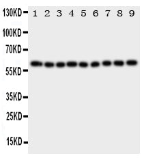 Anti-IL5RA antibody, PA1619, Western blotting
All lanes: Anti IL5RA (PA1619) at 0.5ug/ml

Lane 1: A549 Whole Cell Lysate at 40ug

Lane 2: SMMC Whole Cell Lysate at 40ug

Lane 3: U87 Whole Cell Lysate at 40ug

Lane 4: 293T Whole Cell Lysate at 40ug

Lane 5: PANC Whole Cell Lysate at 40ug

Lane 6: HELA Whole Cell Lysate at 40ug

Lane 7: JURKAT Whole Cell Lysate at 40ug

Lane 8: RAJI Whole Cell Lysate at 40ug

Lane 9: CEM Whole Cell Lysate at 40ug

Predicted bind size: 48KD

Observed bind size: 60KD