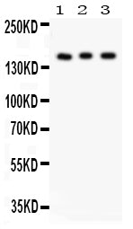 Anti-Insulin Receptor antibody, PA1620, Western blotting
All lanes: Anti Insulin Receptor(PA1620) at 0.5ug/ml
Lane 1: Rat Kidney Tissue Lysate at 50ug
Lane 2: PANC Whole Cell Lysate at 40ug
Lane 3: HELA Whole Cell Lysate at 40ug
Predicted bind size: 155KD
Observed bind size: 155KD
