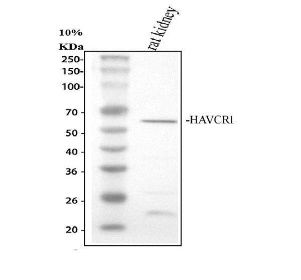 Anti-TIM 1/HAVCR1 Antibody Picoband®