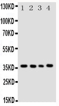 Anti-Bub3 antibody, PA1645, Western blotting
All lanes: Anti Bub3 (PA1645) at 0.5ug/ml
Lane 1: HELA Whole Cell Lysate at 40ug
Lane 2: A549 Whole Cell Lysate at 40ug
Lane 3: JURKAT Whole Cell Lysate at 40ug
Lane 4: COLO320 Whole Cell Lysate at 40ug
Predicted bind size: 37KD
Observed bind size: 37KD