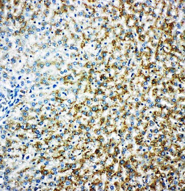 Anti-MAOB antibody, PA1649, IHC(P)
IHC(P): Rat Liver Tissue