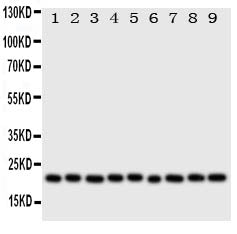 Anti-Cytoglobin/CYGB Antibody Picoband®