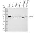Anti-Retinal dehydrogenase 1 ALDH1A1 Antibody Picoband®