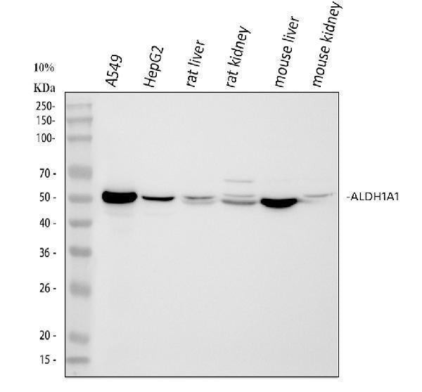 Anti-Retinal dehydrogenase 1 ALDH1A1 Antibody Picoband®