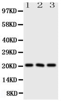 Anti-Fibroblast growth factor 21 FGF21 Antibody Picoband®