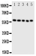 Anti-ERp57 antibody, PA1679, Western blotting
Lane 1: SMMC Cell Lysate 
Lane 2: A549 Cell Lysate
Lane 3: U87 Cell Lysate
Lane 4: HELA Cell Lysate
Lane 5: MCF-7 Cell Lysate