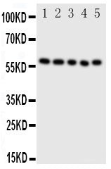 Anti-ERp57 antibody, PA1679, Western blotting
Lane 1: SMMC Cell Lysate 
Lane 2: A549 Cell Lysate
Lane 3: U87 Cell Lysate
Lane 4: HELA Cell Lysate
Lane 5: MCF-7 Cell Lysate