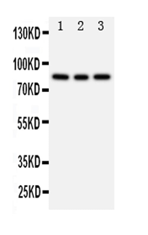 Anti-PI 3 Kinase p85 beta/PIK3R2 Antibody Picoband®