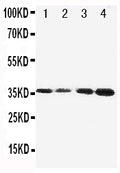 Anti-Protein C/PROC Antibody Picoband®
