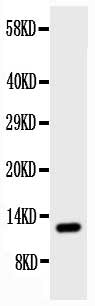 Anti-Estrogen Inducible Protein pS2 antibody, PA1690, Western blotting
WB: Rat Stomach Tissue Lysate