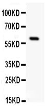 Anti-SSTR1 antibody, PA1693, Western blotting
All lanes: Anti SSTR1 (PA1693) at 0.5ug/ml
WB: Rat Intestine Tissue Lysate at 50ug
Predicted bind size: 43KD
Observed bind size: 60KD