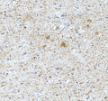Anti-Tenascin-R TNR Antibody Picoband®