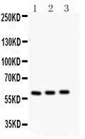 Anti-CYP11A1 antibody, PA1698-1, Western blotting
All lanes: Anti CYP11A1 (PA1698-1) at 0.5ug/ml
Lane 1: Rat Testis Tissue Lysate at 50ug
Lane 2: Mouse Testis Tissue Lysate at 50ug
Lane 3: Mouse Brain Tissue Lysate at 50ug
Predicted bind size: 60KD
Observed bind size: 60KD