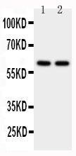 Anti-CYP11A1 antibody, PA1698, Western blotting
WB: Human Placenta Tissue Lysate