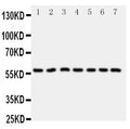 Anti-CYP11B1 antibody, PA1699, Western blotting
All lanes: Anti CYP11B1 (PA1699) at 0.5ug/ml

Lane 1: HELA Whole Cell Lysate at 40ug

Lane 2: U87 Whole Cell Lysate at 40ug

Lane 3: MM231 Whole Cell Lysate at 40ug

Lane 4: PANC Whole Cell Lysate at 40ug

Lane 5: MM453 Whole Cell Lysate at 40ug

Lane 6: HELA Whole Cell Lysate at 40ug

Lane 7: SMMC Whole Cell Lysate at 40ug

Predicted bind size: 58KD

Observed bind size: 58KD