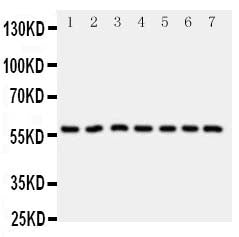 Anti-CYP11B1 antibody, PA1699, Western blotting
All lanes: Anti CYP11B1 (PA1699) at 0.5ug/ml

Lane 1: HELA Whole Cell Lysate at 40ug

Lane 2: U87 Whole Cell Lysate at 40ug

Lane 3: MM231 Whole Cell Lysate at 40ug

Lane 4: PANC Whole Cell Lysate at 40ug

Lane 5: MM453 Whole Cell Lysate at 40ug

Lane 6: HELA Whole Cell Lysate at 40ug

Lane 7: SMMC Whole Cell Lysate at 40ug

Predicted bind size: 58KD

Observed bind size: 58KD