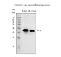 Anti-Interleukin-6 IL6 Antibody Picoband®