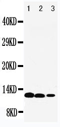 Anti-IL-13 antibody, PA1701, Western blotting
Lane 1: Recombinant Human IL-13 Protein 10ng
Lane 2: Recombinant Human IL-13 Protein 5ng
Lane 3: Recombinant Human IL-13 Protein 2.5ng