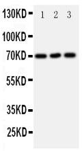 Anti-SLC6A4 antibody, PA1705, Western blotting
All lanes: Anti SLC6A4 (PA1705) at 0.5ug/ml

Lane 1: U87 Whole Cell Lysate at 40ug

Lane 2: HELA Whole Cell Lysate at 40ug

Lane 3: JURKAT Whole Cell Lysate at 40ug

Predicted bind size: 70KD

Observed bind size: 70KD