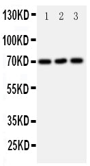 Anti-SLC6A4 antibody, PA1705, Western blotting
All lanes: Anti SLC6A4 (PA1705) at 0.5ug/ml

Lane 1: U87 Whole Cell Lysate at 40ug

Lane 2: HELA Whole Cell Lysate at 40ug

Lane 3: JURKAT Whole Cell Lysate at 40ug

Predicted bind size: 70KD

Observed bind size: 70KD