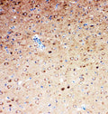 Anti-SLC6A4 antibody, PA1706, IHC(P)
IHC(P): Rat Brain Tissue