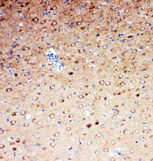 Anti-SLC6A4 antibody, PA1706, IHC(P)
IHC(P): Rat Brain Tissue