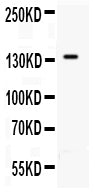 Anti-CD62P antibody, PA1715, Western blotting
All lanes: Anti CD62P (PA1715) at 0.5ug/ml
WB:  PANC Whole Cell Lysate at 40ug
Predicted bind size: 91KD
Observed bind size: 140KD