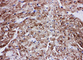 Anti-Glucose Transporter GLUT4/SLC2A4 Antibody Picoband®