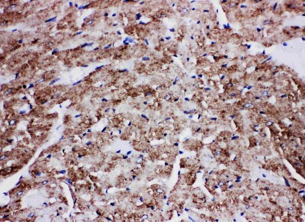 Anti-Glucose Transporter GLUT4/SLC2A4 Antibody Picoband®
