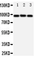 Anti-ABCB6 antibody, PA1723, Western blotting
All lanes: Anti ABCB6 (PA1723) at 0.5ug/ml

Lane 1: HELA Whole Cell Lysate at 40ug

Lane 2: MCF-7 Whole Cell Lysate at 40ug

Lane 3: A549 Whole Cell Lysate at 40ug

Predicted bind size: 94KD

Observed bind size: 94KD