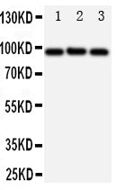 Anti-ABCB6 antibody, PA1723, Western blotting
All lanes: Anti ABCB6 (PA1723) at 0.5ug/ml

Lane 1: HELA Whole Cell Lysate at 40ug

Lane 2: MCF-7 Whole Cell Lysate at 40ug

Lane 3: A549 Whole Cell Lysate at 40ug

Predicted bind size: 94KD

Observed bind size: 94KD