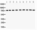 Anti-Growth hormone receptor/GHR Antibody Picoband®