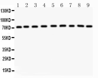 Anti-Growth hormone receptor/GHR Antibody Picoband®