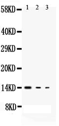 Anti-IL-3 antibody, PA1728, Western blotting
All lanes: Anti IL-3 (PA1728) at 0.5ug/ml
Lane 1: Recombinant Mouse IL-3 Protein 10ng
Lane 2: Recombinant Mouse IL-3 Protein 5ng
Lane 3: Recombinant Mouse IL-3 Protein 2.5ng
Predicted bind size: 14KD
Observed bind size: 14KD