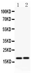 Anti-Caspase-8(p18) antibody, PA1735, Western blotting
All lanes: Anti Caspase-8(p18) (PA1735) at 0.5ug/ml
Lane 1: A549 Whole Cell Lysate at 40ug
Lane 2: HELA Whole Cell Lysate at 40ug
Predicted bind size: 18KD
Observed bind size: 18KD