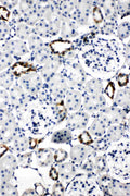 Anti-Aquaporin 2 antibody, PA1742, IHC(P)
IHC(P): Rat Kidney Tissue