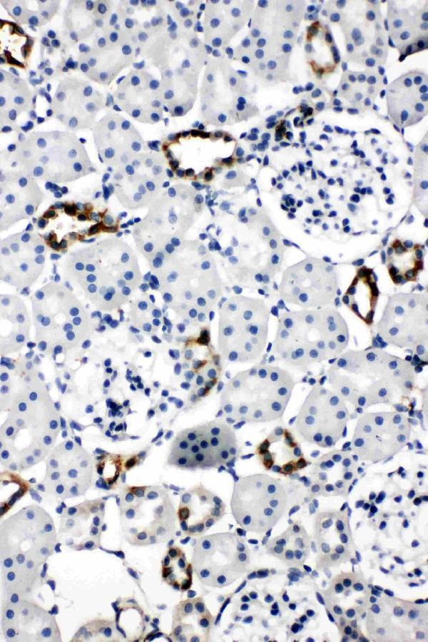 Anti-Aquaporin 2 antibody, PA1742, IHC(P)
IHC(P): Rat Kidney Tissue