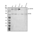 Anti-IGF1 Receptor/IGF1R Antibody Picoband®