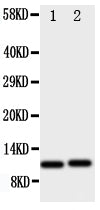 Anti-GRO alpha antibody, PA1760, Western blotting
All lanes: Anti GRO alpha (PA1760) at 0.5ug/ml

Lane 1: HELA Whole Cell Lysate at 40ug

Lane 2: JURKAT Whole Cell Lysate at 40ug

Predicted bind size: 11KD

Observed bind size: 11KD