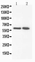 Anti-FMO3 antibody, PA1764, Western blotting
Lane 1: Rat Liver Tissue Lysate 
Lane 2: Rat Liver Tissue Lysate