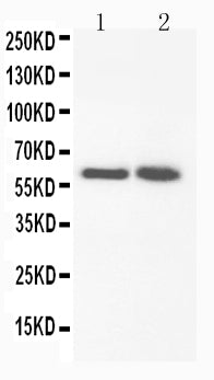 Anti-FMO3 antibody, PA1764, Western blotting
Lane 1: Rat Liver Tissue Lysate 
Lane 2: Rat Liver Tissue Lysate