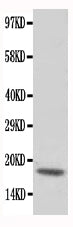 Anti-cardiac Troponin C/TNNC1 Antibody Picoband®