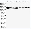 Anti-Vinculin antibody, PA1781, Western blotting
Lane 1: Rat Heart Tissue Lysate 
Lane 2: Rat Brain Tissue Lysate 
Lane 3: Rat Liver Tissue Lysate 
Lane 4: U87 Cell Lysate 
Lane 5: SMMC Cell Lysate 
Lane 6: HEPA Cell Lysate 
Lane 7:  HELA Cell Lysate
 
Lane 8: HT1080 Cell Lysate