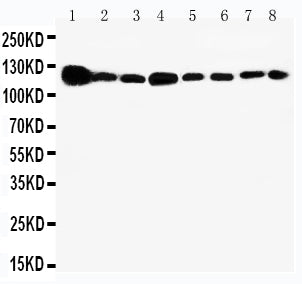 Anti-Vinculin antibody, PA1781, Western blotting
Lane 1: Rat Heart Tissue Lysate 
Lane 2: Rat Brain Tissue Lysate 
Lane 3: Rat Liver Tissue Lysate 
Lane 4: U87 Cell Lysate 
Lane 5: SMMC Cell Lysate 
Lane 6: HEPA Cell Lysate 
Lane 7:  HELA Cell Lysate
 
Lane 8: HT1080 Cell Lysate