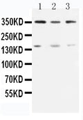 Anti-ATM antibody, PA1784, Western blotting
Lane 1: Rat Testis Tissue Lysate 
Lane 2: U87 Cell Lysate 
Lane 3: MCF-7 Cell Lysate