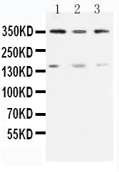 Anti-ATM antibody, PA1784, Western blotting
Lane 1: Rat Testis Tissue Lysate 
Lane 2: U87 Cell Lysate 
Lane 3: MCF-7 Cell Lysate