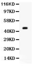 Anti-AURKA antibody, PA1785, Western blotting
All lanes: Anti AURKA (PA1785) at 0.5ug/ml
WB: Mouse Ovary Tissue Lysate at 50ug
Predicted bind size: 46KD
Observed bind size: 46KD