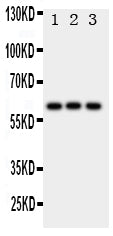 Anti-HEXA antibody, PA1787, Western blotting
All lanes: Anti HEXA (PA1787) at 0.5ug/ml

Lane 1: Rat Liver Tissue Lysate at 50ug

Lane 2: HELA Whole Cell Lysate at 40ug

Lane 3: SMMC Whole Cell Lysate at 40ug

Predicted bind size: 61KD

Observed bind size: 61KD