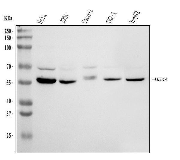 Anti-HEXA Antibody Picoband®