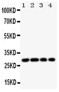 Anti-HLA DMB/HLA-DMB Antibody Picoband®